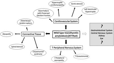 Neuromuscular manifestations of wild type transthyretin amyloidosis: a review and single center’s experience